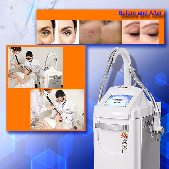 15W 1~20ms/DOT Pulse Width 20*20mm Scan Area Acne Scar Removal Vertical Device